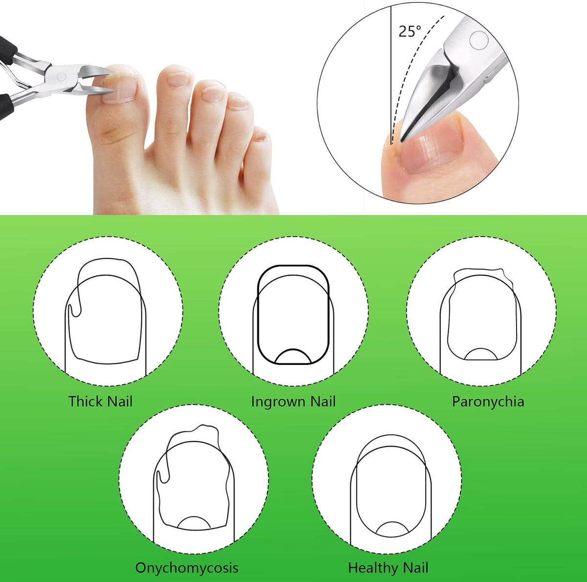 Heavy Duty Ingrown Toenail Clippers, Stainless Steel Toe Nail Trimmer