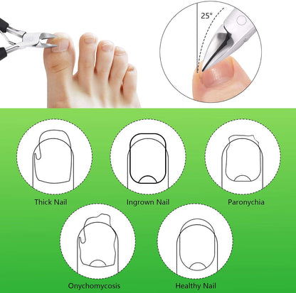 Heavy Duty Ingrown Toenail Clippers, Stainless Steel Toe Nail Trimmer