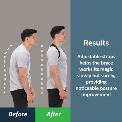 Posture Corrector for Men and Women, Back Brace Straightener