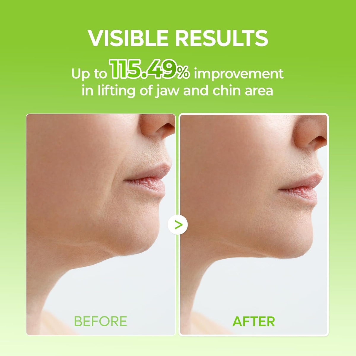 CACTOX V-Lifting Mewing Band – Cactox + Caffeine + Collagen Double Chin Lifting Band for Sagging Jawline & Facial Puffiness | 115.49% Jaw & Chin Lifting Improvement | Korean V-Line Lifting